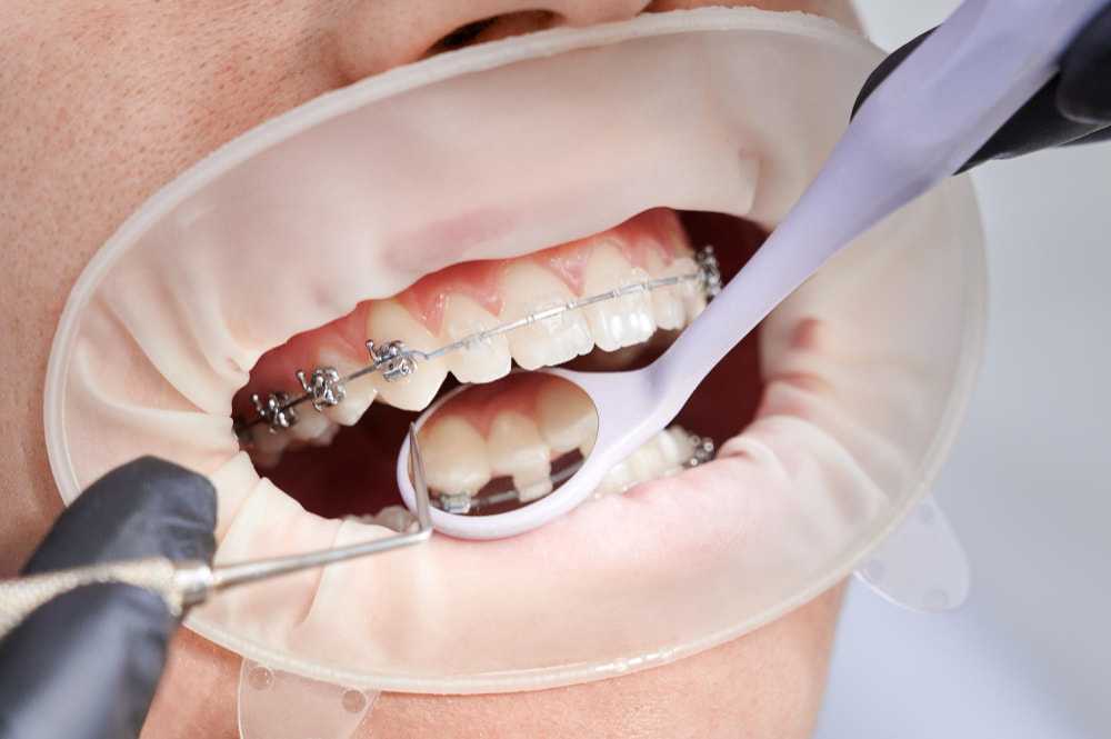 Orthodontist Henderson NV